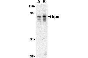 Western Blotting (WB) image for anti-Lipase, Hormone-Sensitive (LIPE) (C-Term) antibody (ABIN1030485) (LIPE Antikörper  (C-Term))