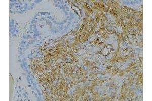 ABIN6273324 at 1/100 staining Human uterus tissue by IHC-P. (SRPX2 Antikörper  (Internal Region))