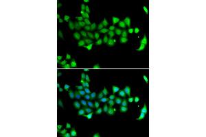 Immunofluorescence analysis of A549 cells using HSPA14 antibody. (HSPA14 Antikörper)