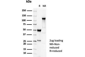 SDS-PAGE Analysis Purified TUBB3 Recombinant Rabbit Monoclonal Antibody (TUBB3/7089R). (Rekombinanter TUBB3 Antikörper  (AA 437-450))