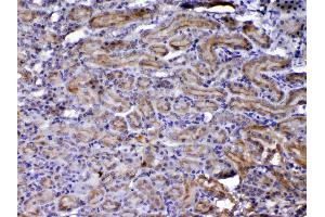 Immunohistochemistry (IHC) image for anti-Nephroblastoma Overexpressed (NOV) (AA 334-357), (C-Term) antibody (ABIN5518938)