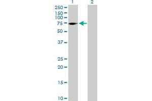 Western Blot analysis of ZNF571 expression in transfected 293T cell line by ZNF571 MaxPab polyclonal antibody. (ZNF571 Antikörper  (AA 1-609))
