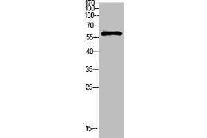 Western Blot analysis of mouse-kidney cells using Antibody diluted at 1000 (FBXO7 Antikörper  (AA 371-420))