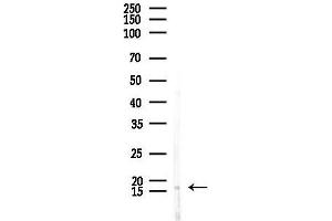 anti-Mediator Complex Subunit 10 (MED10) (Internal Region) antibody