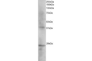 ABIN184618 staining (2µg/ml) of Human Kidney extracts (RIPA buffer, 35µg total protein per lane).