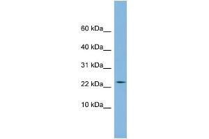 WB Suggested Anti-PPIL3 Antibody Titration:  0. (PPIL3 Antikörper  (Middle Region))