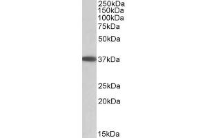 ABIN571230 (0. (MOGAT2 Antikörper  (Internal Region))