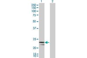 Western Blot analysis of MRPS23 expression in transfected 293T cell line by MRPS23 MaxPab polyclonal antibody. (MRPS23 Antikörper  (AA 1-190))