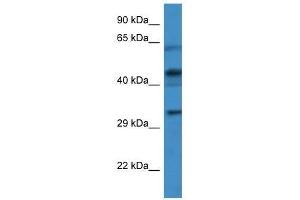 Western Blot showing CRLF1 antibody used at a concentration of 1. (CRLF1 Antikörper  (Middle Region))