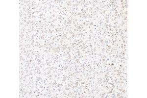 Immunohistochemistry (IHC) image for anti-Mediator Complex Subunit 12 (MED12) (C-Term) antibody (ABIN7453548) (MED12 Antikörper  (C-Term))