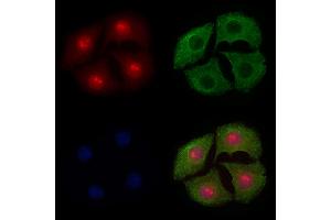 ABIN6255069 and ABIN6267579 staining Hela cells(4h of LPS treatment) by IF/ICC. (FOXO4 Antikörper  (pSer197))
