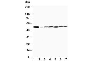 Western blot testing of MAPK8/9 antibody and Lane 1:  rat brain (MAPK8 / MAPK9 (Middle Region) Antikörper)