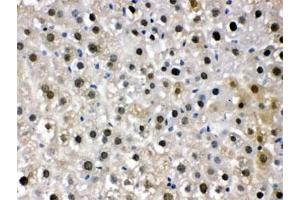 IHC testing of FFPE mouse liver with DDB1 antibody. (DDB1 Antikörper  (AA 1011-1140))