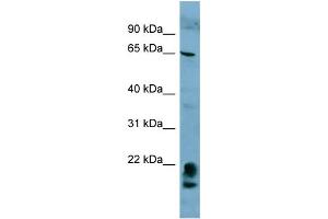 WB Suggested Anti-FAM134A  Antibody Titration: 0. (FAM134A Antikörper  (N-Term))