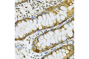 Immunohistochemistry of paraffin-embedded human colon using HSP90AB1 Antibody. (HSP90AB1 Antikörper)