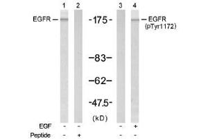 Image no. 1 for anti-Epidermal Growth Factor Receptor (EGFR) (Tyr1172) antibody (ABIN197448) (EGFR Antikörper  (Tyr1172))