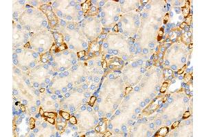 ABIN6257351 and ABIN6274731 at 1/100 staining Rat kidney tissue by IHC-P. (MRPL15 Antikörper  (Internal Region))