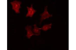 ABIN6275787 staining HepG2 cells by IF/ICC. (SRCIN1 Antikörper  (Internal Region))