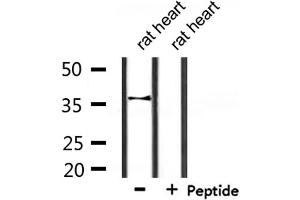 Western blot analysis of extracts from rat heart, using CACNG7 Antibody. (CACNG7 Antikörper  (Internal Region))