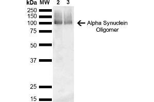 Western Blot analysis of Mouse, Rat Brain showing detection of 14 kDa Alpha Synuclein protein using Mouse Anti-Alpha Synuclein Monoclonal Antibody, Clone 3C11 (ABIN5564053). (SNCA Antikörper)
