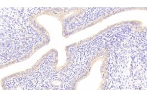 Detection of DKK1 in Rat Uterus Tissue using Polyclonal Antibody to Dickkopf Related Protein 1 (DKK1) (DKK1 Antikörper  (AA 36-260))
