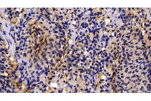 Immunohistochemistry (IHC) image for anti-Caspase 1 (CASP1) (AA 317-404) antibody (ABIN7438055)