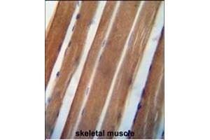 NDUAB antibody (Center) (ABIN654477 and ABIN2844212) immunohistochemistry analysis in formalin fixed and paraffin embedded human skeletal muscle followed by peroxidase conjugation of the secondary antibody and DAB staining. (NDUFA11 Antikörper  (AA 64-92))