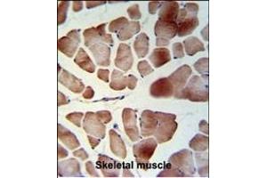 TL1 Antibody (C-term) (ABIN653753 and ABIN2843053) IHC analysis in formalin fixed and raffin embedded skeletal muscle followed by peroxidase conjugation of the secondary antibody and DAB staining. (PATL1 Antikörper  (C-Term))