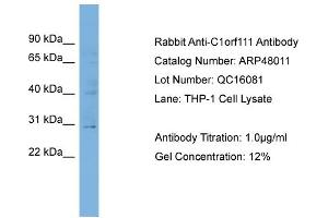 WB Suggested Anti-C1orf111  Antibody Titration: 0. (C1ORF111 Antikörper  (N-Term))
