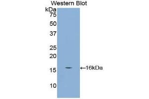 Western blot analysis of the recombinant protein. (CUBN Antikörper  (AA 3157-3274))