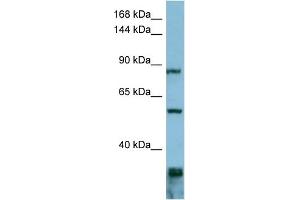 WB Suggested Anti-EPS8  Antibody Titration: 0. (EPS8 Antikörper  (Middle Region))