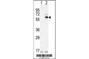 Western blot analysis of KNG1 using rabbit polyclonal KNG1 Antibody using 293 cell lysates (2 ug/lane) either nontransfected (Lane 1) or transiently transfected (Lane 2) with the KNG1 gene. (KNG1 Antikörper  (N-Term))
