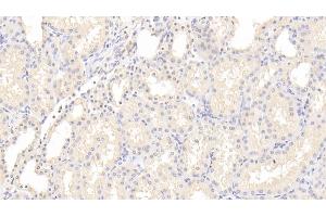 Immunohistochemistry (IHC) image for anti-Insulin Receptor (INSR) (AA 1027-1364) antibody (ABIN7438022)