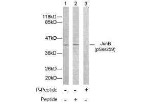 Image no. 2 for anti-Jun B Proto-Oncogene (JUNB) (pSer259) antibody (ABIN196658) (JunB Antikörper  (pSer259))