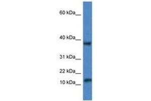 Image no. 1 for anti-Vesicle-Associated Membrane Protein 1 (Synaptobrevin 1) (VAMP1) (AA 53-102) antibody (ABIN6747255)