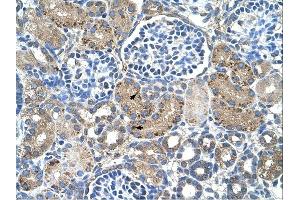 GLS2 antibody was used for immunohistochemistry at a concentration of 4-8 ug/ml. (GLS2 Antikörper)
