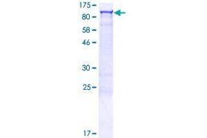 CALCOCO1 Protein (AA 1-691) (GST tag)