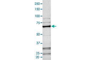 Image no. 1 for B-Raf proto-oncogene, serine/threonine kinase (BRAF) (AA 417-766) (Active) protein (His-GST) (ABIN5570017)