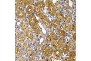 Immunohistochemistry of paraffin-embedded rat kidney using PRKAB1 antibody (ABIN5995401) at dilution of 1/100 (40x lens). (PRKAB1 Antikörper)