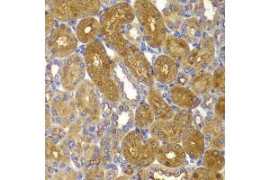Immunohistochemistry of paraffin-embedded rat kidney using PRKAB1 antibody (ABIN5995401) at dilution of 1/100 (40x lens).