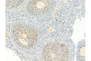 ABIN6256592 and ABIN6267253 at 1/100 staining Rat ovary tissue by IHC-P. (CHEK2 Antikörper  (pThr68))