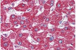 Human Liver (formalin-fixed, paraffin-embedded) stained with HSPD1 antibody ABIN294973 at 5 ug/ml followed by biotinylated goat anti-rabbit IgG secondary antibody ABIN481713, alkaline phosphatase-streptavidin and chromogen. (HSPD1 Antikörper  (AA 150-200))