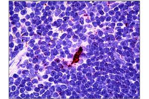 Immunohistochemistry (IHC) image for anti-Interleukin-27 subunit beta (IL-27b) antibody (ABIN781990) (EBI3 Antikörper)