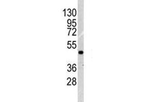 Western Blotting (WB) image for anti-Integrin-Linked Kinase (ILK) (AA 151-180) antibody (ABIN3031390)