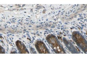 ABIN6274601 at 1/100 staining Mouse intestine tissue by IHC-P. (CDH22 Antikörper  (N-Term))
