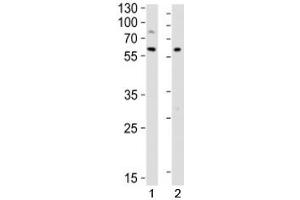 Western Blotting (WB) image for anti-V-Yes-1 Yamaguchi Sarcoma Viral Related Oncogene Homolog (LYN) (N-Term) antibody (ABIN3032776)