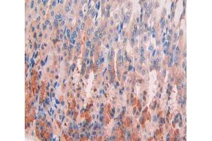 Used in DAB staining on fromalin fixed paraffin- embedded stomach tissue (GPC4 Antikörper  (AA 220-426))