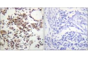 Immunohistochemistry analysis of paraffin-embedded human lymph node, using SYK (Phospho-Tyr323) Antibody. (SYK Antikörper  (pTyr323))