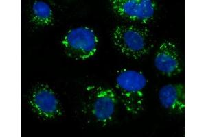 IF analysis of GOLPH2/GOLM1 using anti-GOLPH2/GOLM1 antibody (ABIN7601505).