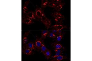 Confocal immunofluorescence analysis of Hela cells using GM130 antibody (ABIN6129789, ABIN6141264, ABIN6141265 and ABIN6220979) at dilution of 1:400.